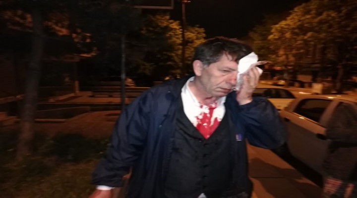 Gazeteciye beyzbol sopalı saldırı