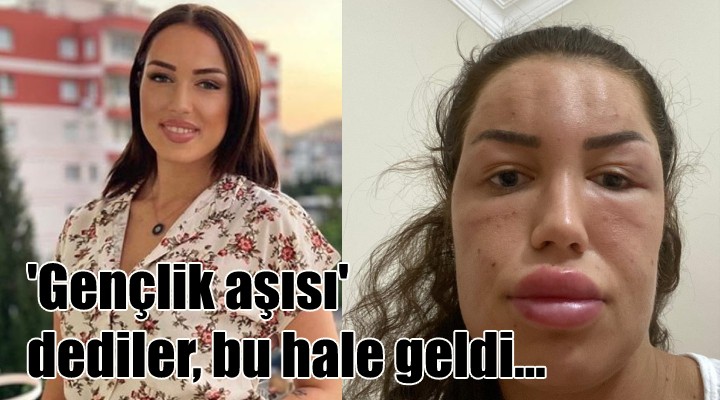  Gençlik aşısı  dediler, bu hale geldi