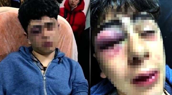 14 yaşındaki çocuğu darp iddiasında 5 polis için karar!