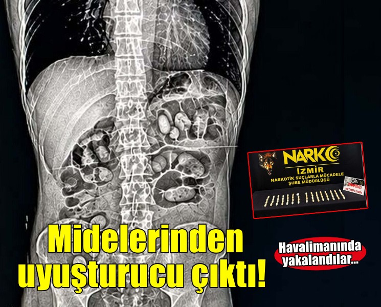 Havalimanında şüpheli 2 yolcunun midelerinden 495 gram metamfetamin çıktı