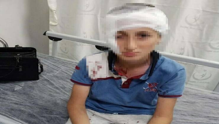 11 yaşındaki çocuğa köpek saldırısında 1,2 milyon TL tazminat kararı