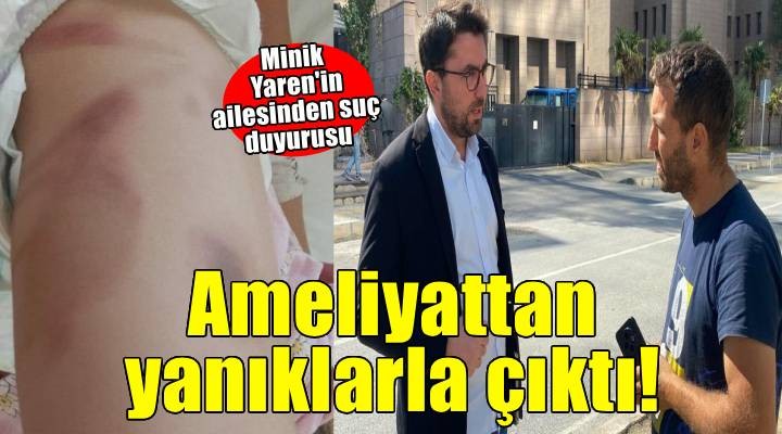3 yaşındaki Yaren ameliyattan yanık izleriyle çıktı aile suç duyurusunda bulundu