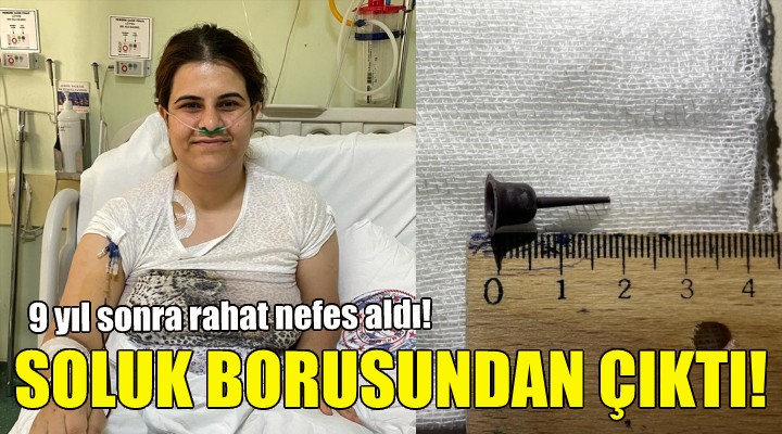 9 yıl sonra soluk borusundan çıkarıldı!