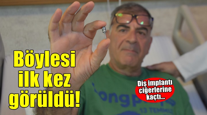 Akciğerinden diş implantı çıktı!