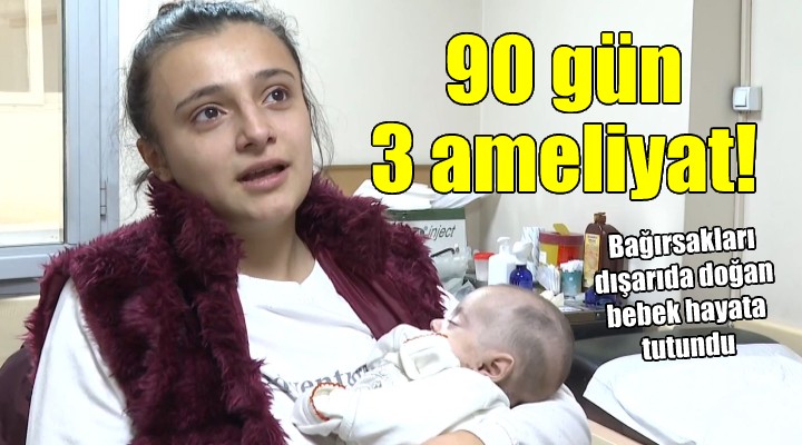 Bağırsakları dışarıda doğan bebek hayata tutundu