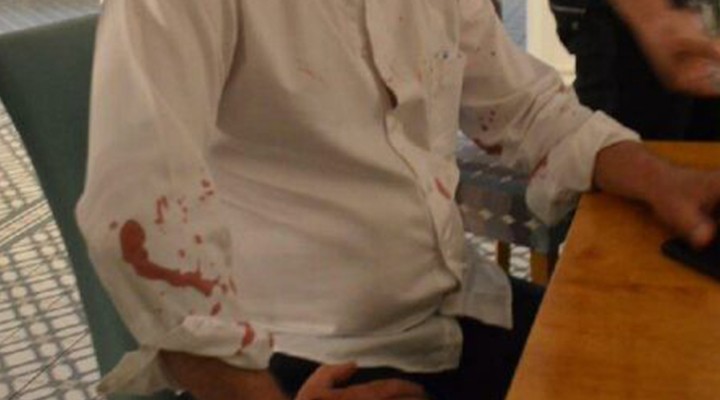 CHP li belediye başkanına beyzbol sopalı saldırı