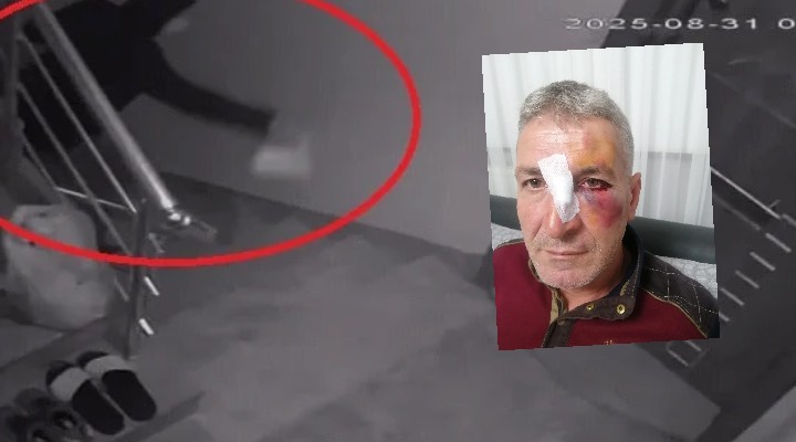 Dışkı ve kızgın yağlı komşu kavgası!