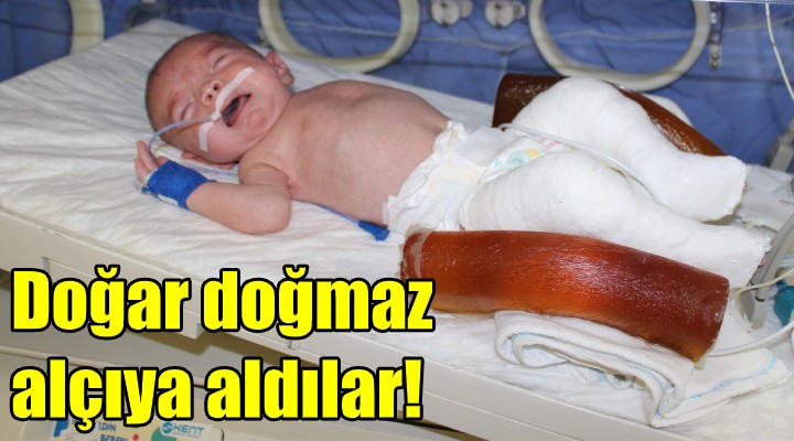 Doğar doğmaz alçıya aldılar!