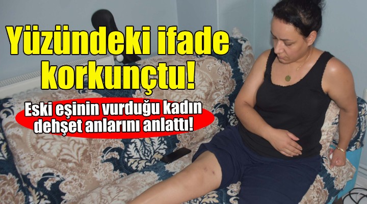 Eski eşi tarafından vurulan kadın dehşet anlarını anlattı!