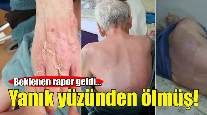 Huzurevinde ölüm... Beklenen rapor geldi!