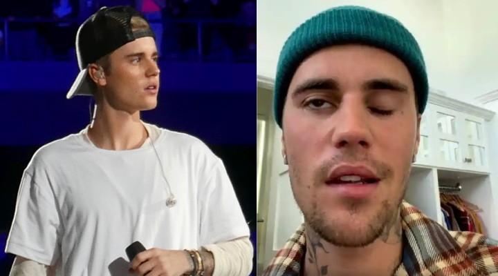 Justin Bieber yüz felci geçirdi!