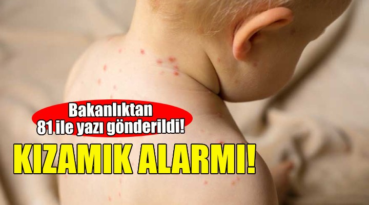 Kızamık alarmı... Bakanlıktan 81 ile yazı!