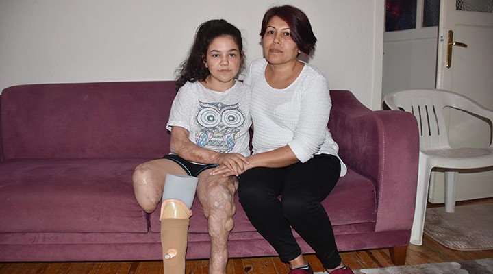 Menenjit yüzünden bacağını kaybeden Melis yardım bekliyor