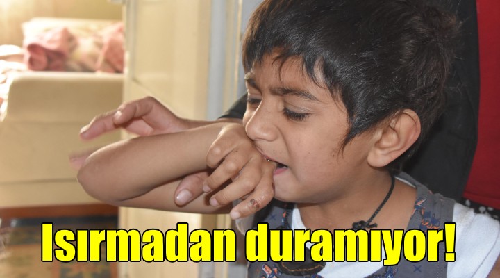 Yusuf ısırmadan duramıyor!