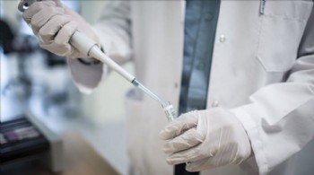 1 Aralık Dünya AIDS Günü: Dünyada yaklaşık 41 milyon kişi AIDS ile yaşıyor