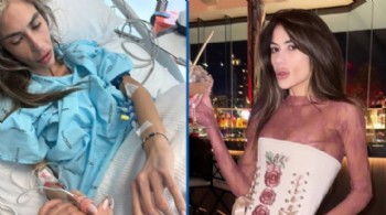 23 kiloya düşen fenomen Nihal Candan, hayatını kaybetti