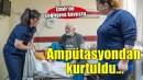 Ampütasyondan son anda kurtuldu