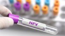 Bakan Memişoğlu’ndan HPV aşısı açıklaması: 2025 yılı sonunda ilgili aşı programımızı başlatmayı planlıyoruz