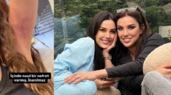 Dilan Polat, Sıla Doğu'dan şiddet gördüğünü açıkladı: Benim böyle bir kardeşim yoktur!