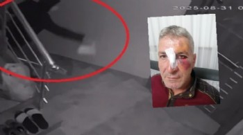 Dışkı ve kızgın yağlı komşu kavgası!