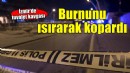 Kavga ettiği kişinin burnunu ısırarak kopardı!