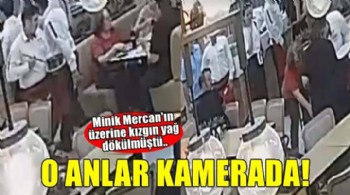 Minik Mercan'ın üzerine kızgın yağ dökülmüştü: O görüntüler kamerada!